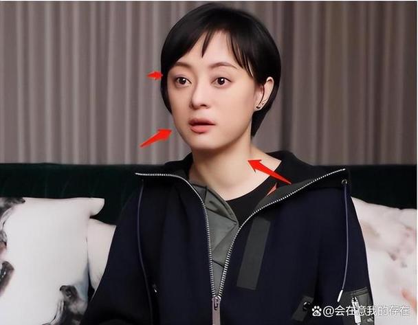 2025新澳门正版挂牌图和孙俪唇下痣没了与孙俪嘴唇的痣