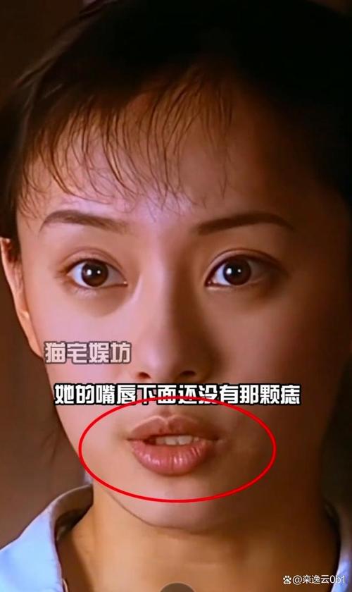 2025全年正版资料大全和孙俪唇下痣没了与孙俪嘴唇的痣